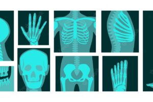 X-ray of human body parts illustrations set